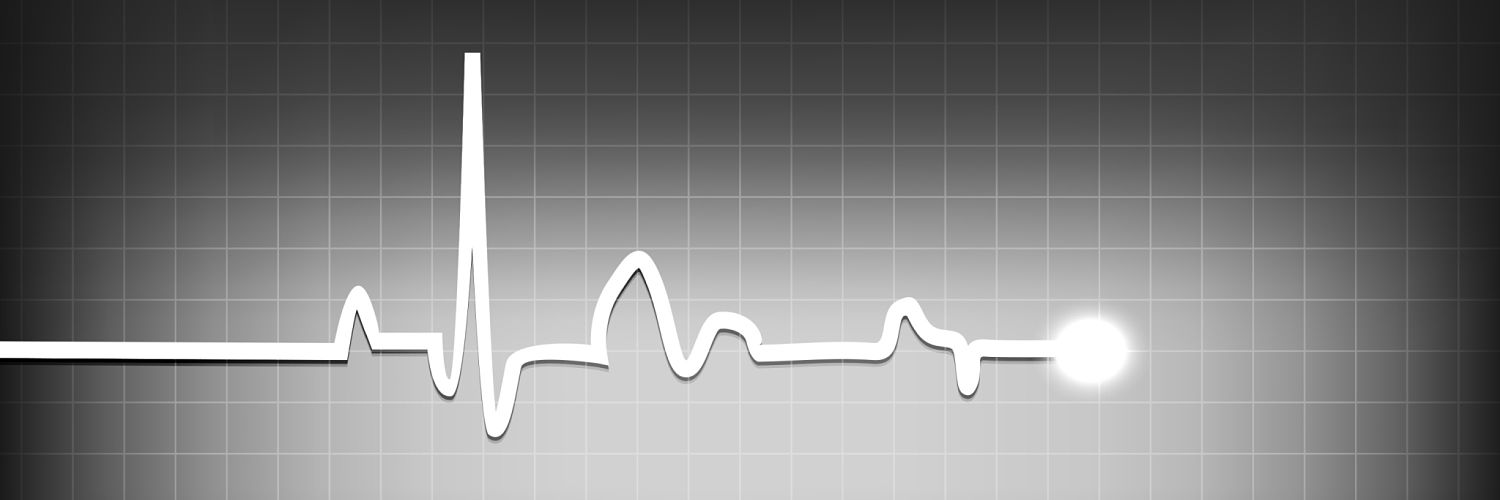 Image of a black-and-white electrocardiogram screen